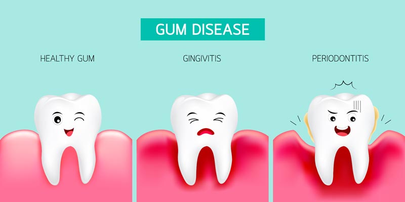 gum disease